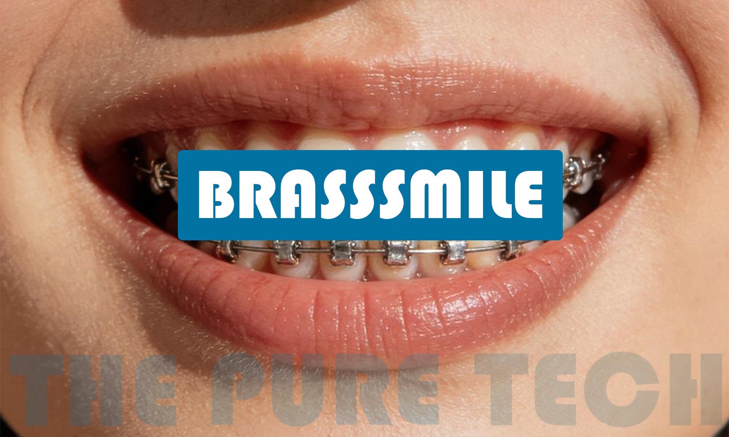 Brasssmile